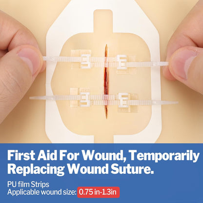 16 Pack Wound Closure Strips, 4 Types Butterfly Bandages, Emergency Laceration Closure Kit, Repair Wounds without Stitches, Quick Clot Zip Stitch Wound Closures Device